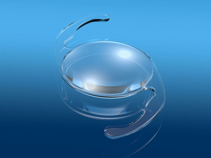 Medically illustration showing intraocular lens (IOL), a lens implanted in the eye as part of a treatment for cataracts or myopia
